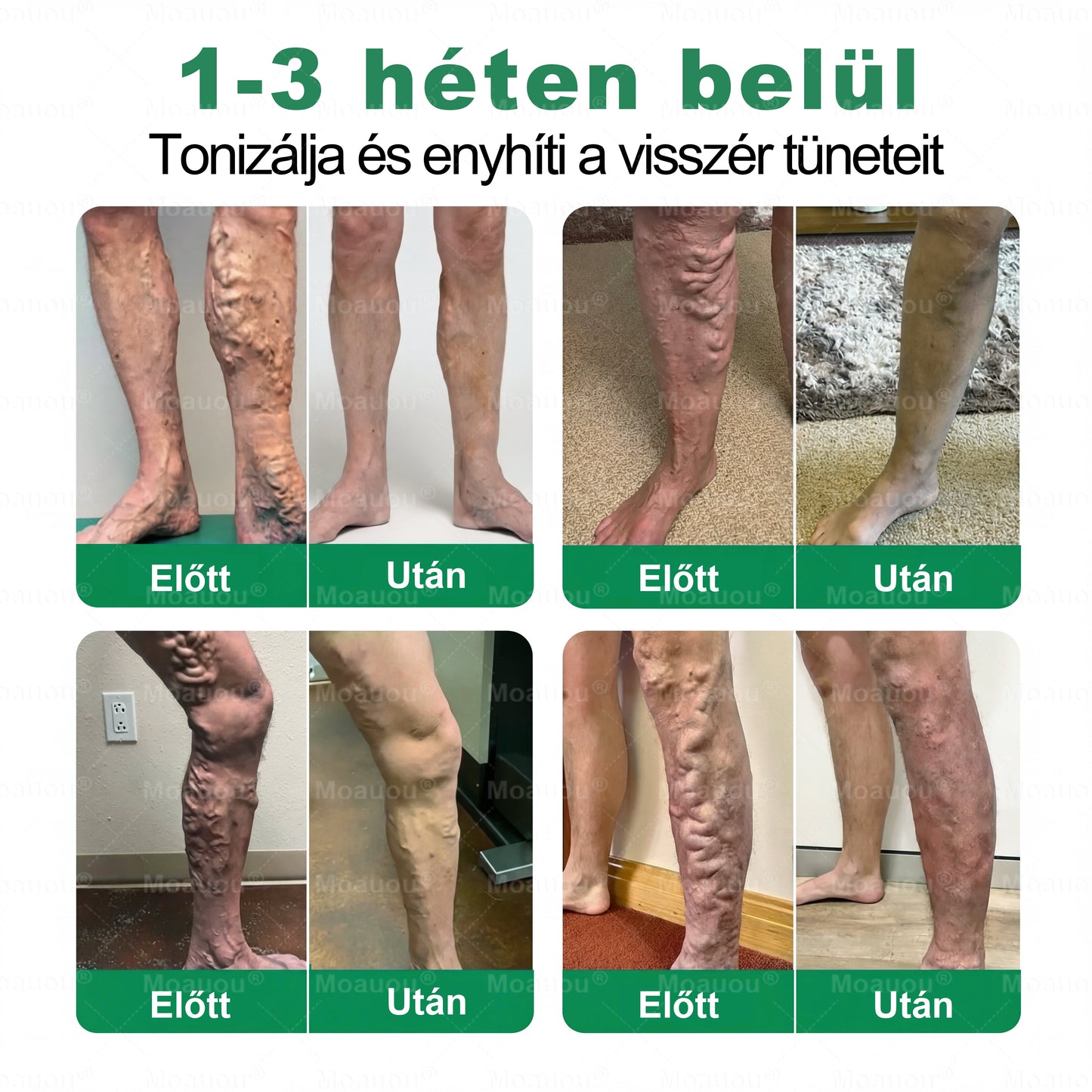 👨‍⚕️✅Moauou® Ércélzó Mikrotűs Tapasz ⚡ Azonnali enyhülés, hosszan tartó eredmények – NAGY AKCIÓ!