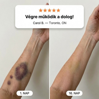 💛✨100K+ ELADVA 💁‍♀️ – PuraCure® Zúzódásjavító és bőrerősítő krém
