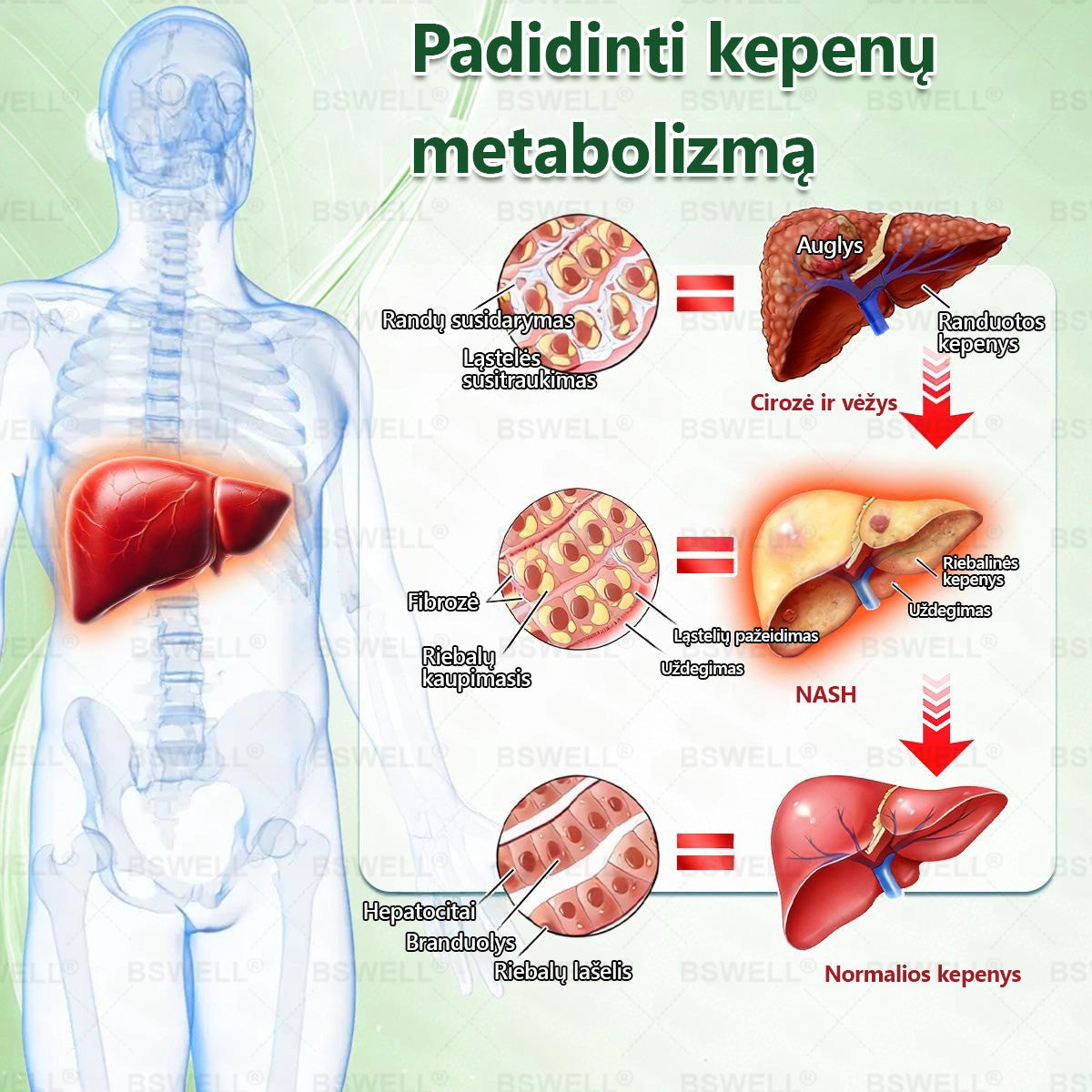 🌿🧑‍⚕️BSWELL® Nano mikroadatinis lieknėjimo pleistras – Matomi pokyčiai per 28 dienas Svorio kontrolei, širdies sveikatai, cukraus balansui, žarnynui ir sąnariams.