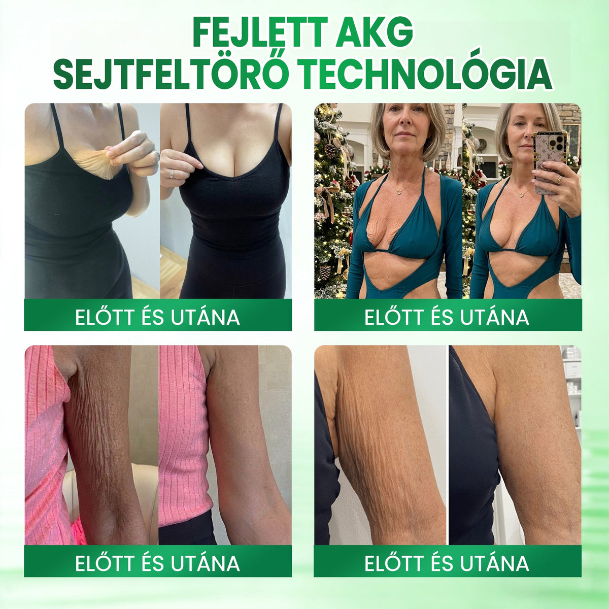 🌻Medistart® AKG BŐRFESZESÍTŐ & ÖREGEDÉS ELLENI ÁPOLÁS