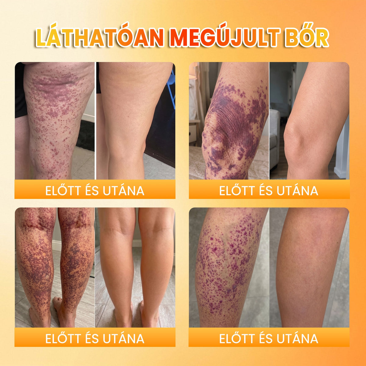📦🥇PuraCure® MÉHMÉREG Bőrmegújító krém