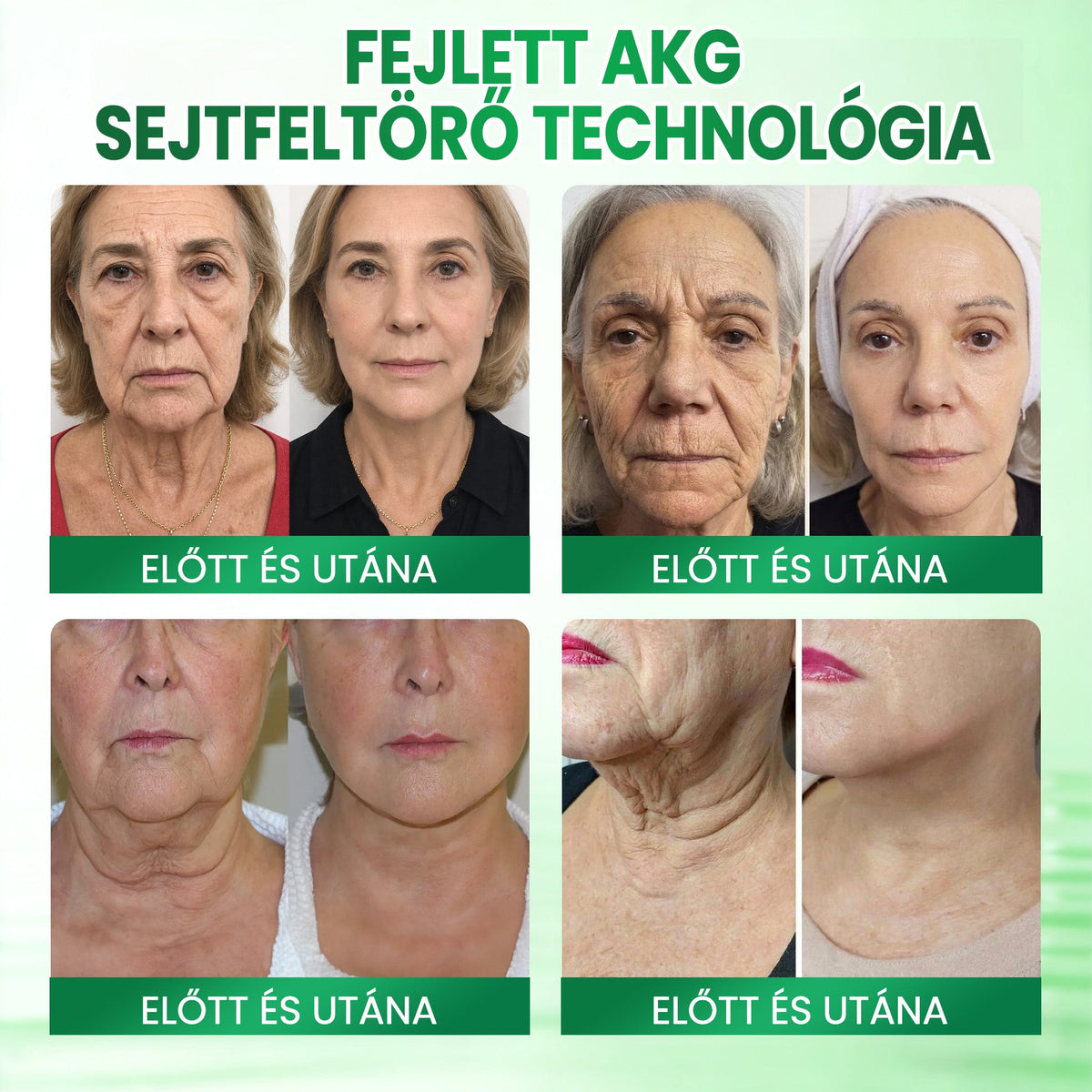 🌻Medistart® AKG BŐRFESZESÍTŐ & ÖREGEDÉS ELLENI ÁPOLÁS