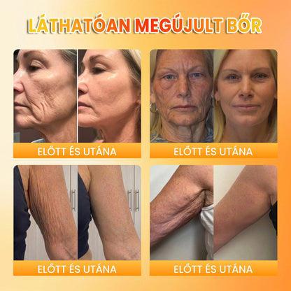 📦🥇PuraCure® MÉHMÉREG Bőrmegújító krém
