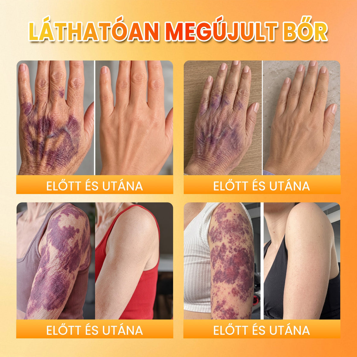 📦🥇PuraCure® MÉHMÉREG Bőrmegújító krém