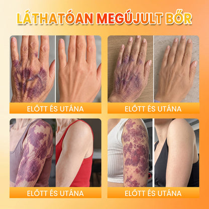 📦🥇PuraCure® MÉHMÉREG Bőrmegújító krém