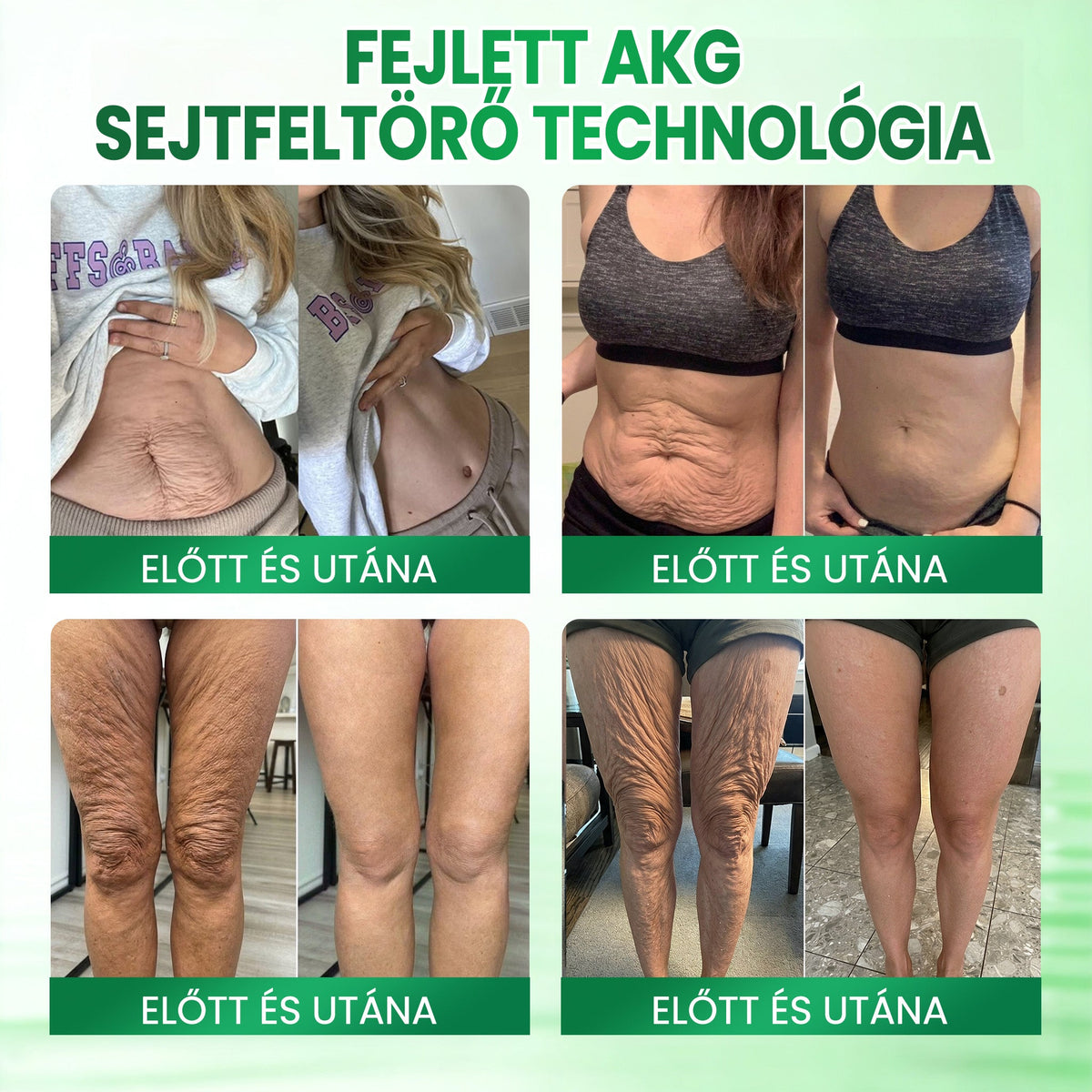 🌻Medistart® AKG BŐRFESZESÍTŐ & ÖREGEDÉS ELLENI ÁPOLÁS