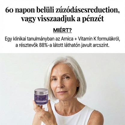 💛✨100K+ ELADVA 💁‍♀️ – PuraCure® Zúzódásjavító és bőrerősítő krém
