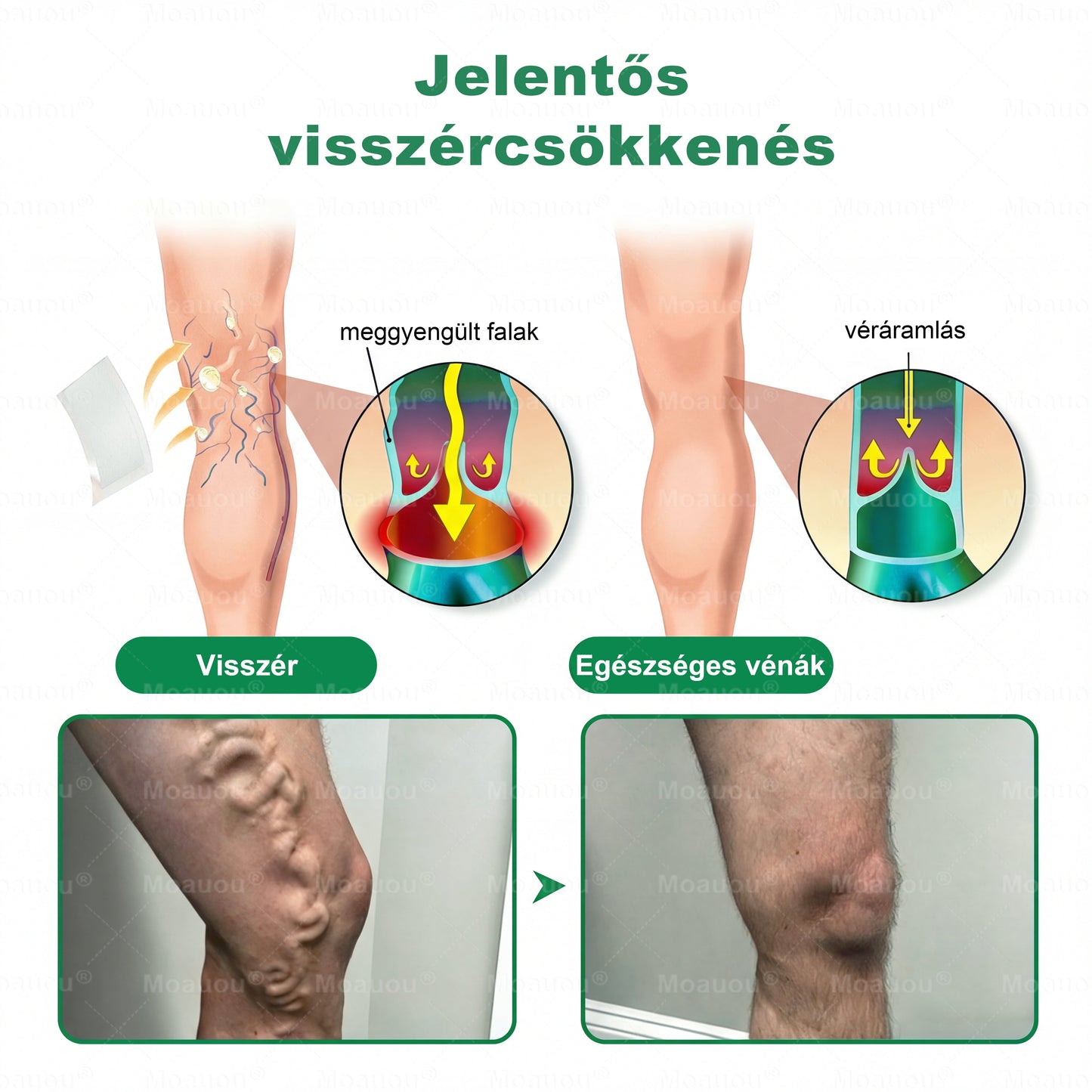 👨‍⚕️✅Moauou® Ércélzó Mikrotűs Tapasz ⚡ Azonnali enyhülés, hosszan tartó eredmények – NAGY AKCIÓ!